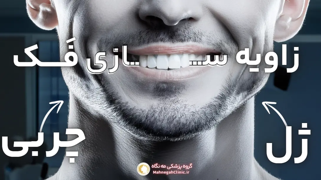 زاویه سازی فک با ژل یا چربی
