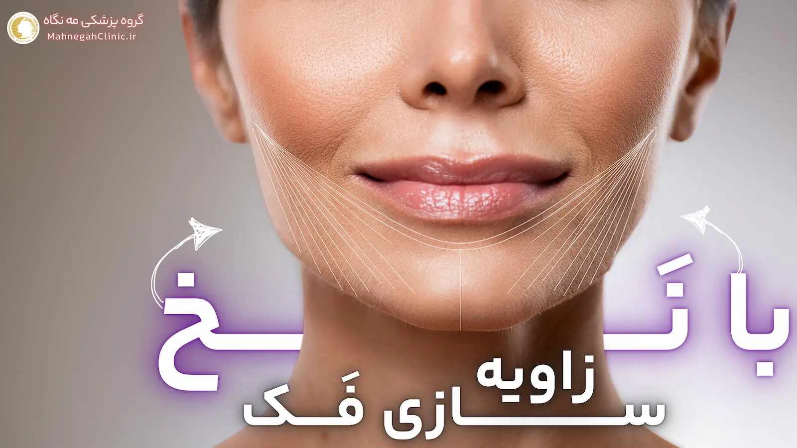 زاویه سازی فک با نخ