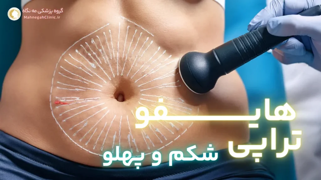 هایفوتراپی شکم و پهلو: هزینه‌ها و مزایا